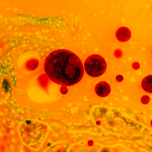 атеросклеротические бляшки холестерин